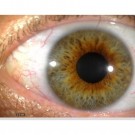 MEDLW4R IriScope Trådløs, 10-20x med 2x2 LED-lys  thumbnail