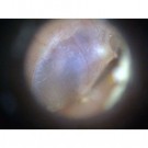 MEDL3E Basic Otoskop 20-30x  thumbnail