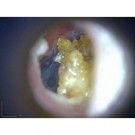 MEDL3E Basic Otoskop 20-30x  thumbnail