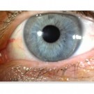 MEDLW4R IriScope Trådløs, 10-20x med 2x2 LED-lys  thumbnail