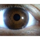MEDLW4R IriScope Trådløs, 10-20x med 2x2 LED-lys  thumbnail